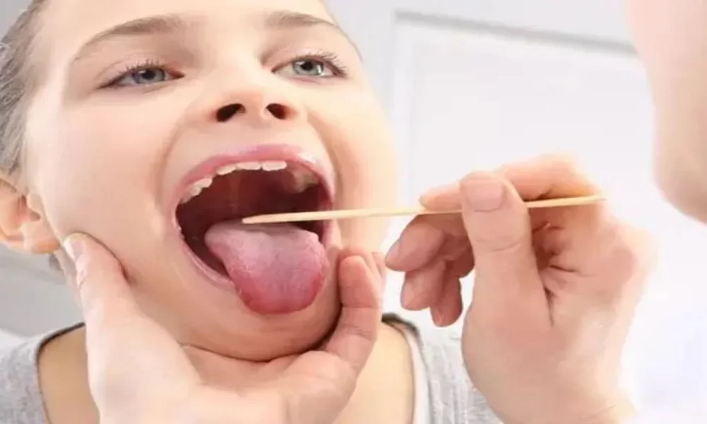 Winter Tonsils Can Cause Cancer So Dont Ignore Them