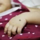 EXPOSURE TO ZIKA VIRUS MAY ALTER BRAIN AGE AS 'CHILDREN GET OLDER'