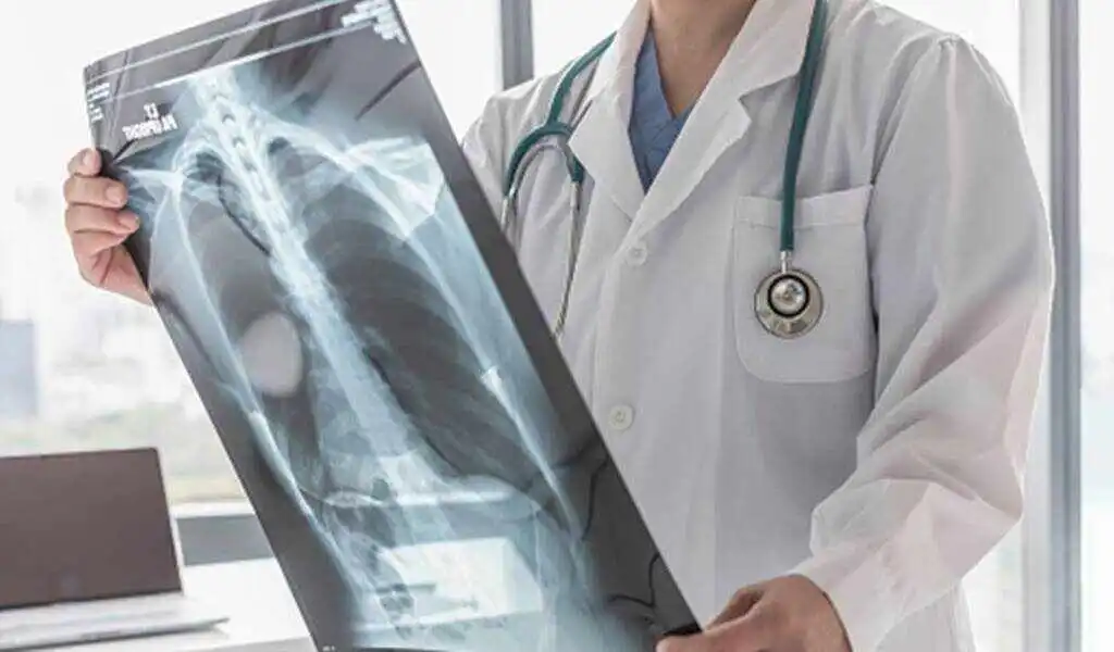 Europe's Multidrug-Resistant Organisms Are On The Rise