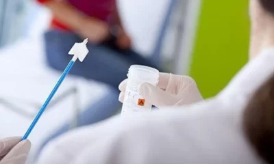 Cervical Cancer Screening: Don't Fear Your Smear