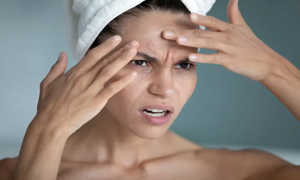 What Does Problematic Facial Skin Signal