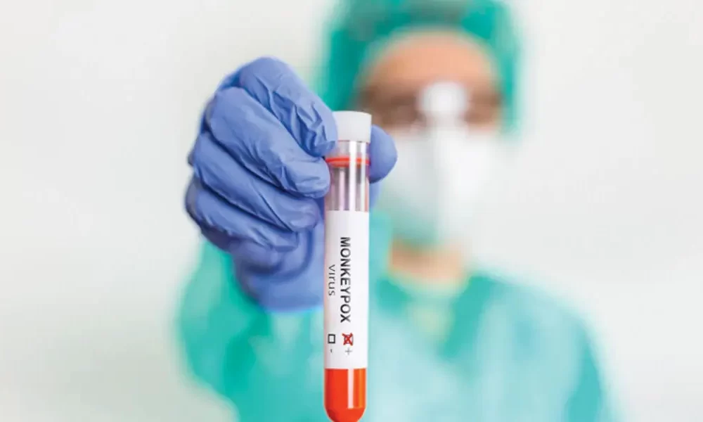 CDC Advisors Unanimously Recommend Jynneos Vaccine for At-Risk Adults in Future Mpox Outbreaks