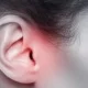 Symptoms and Treatment of Ear Infection