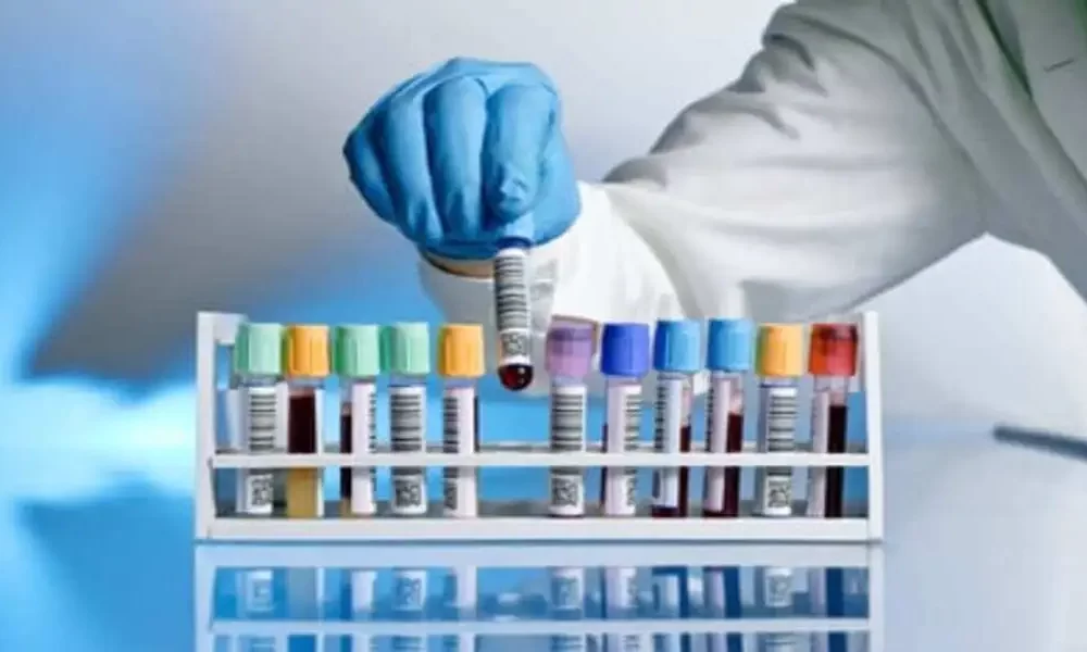 Chronic Kidney Disease And Type 2 Diabetes Patients Needed For Trial
