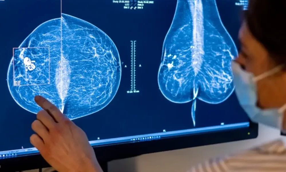 breast density