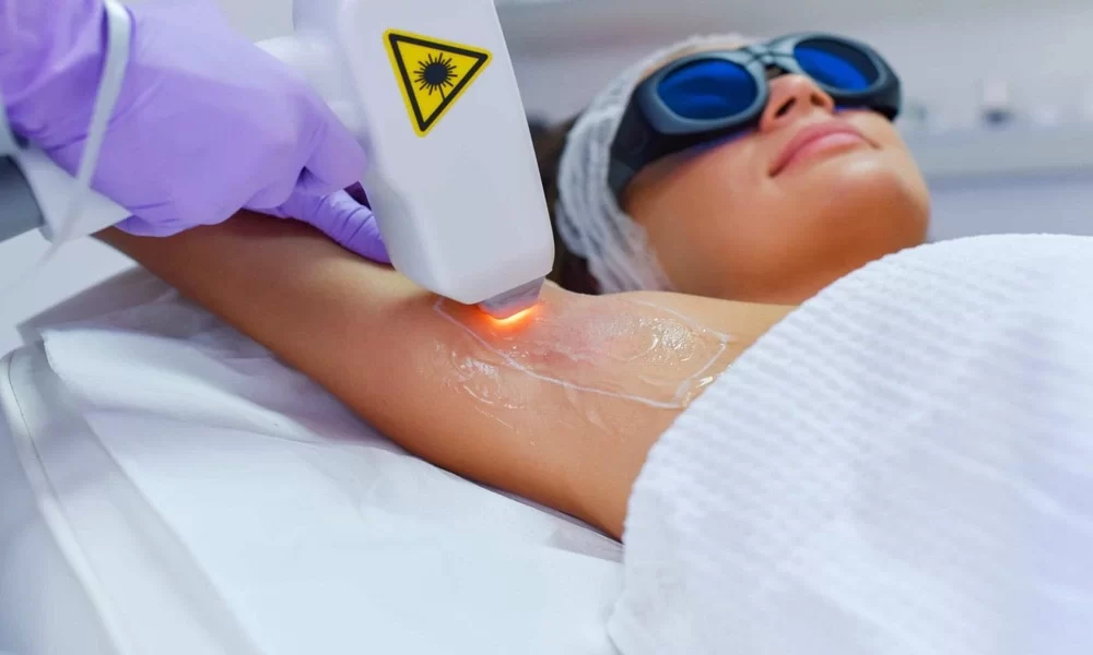 High Quality Laser Hair Removal