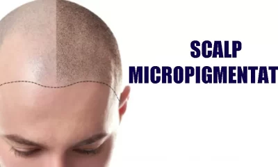 Scalp Micro Pigmentation