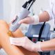 Laser Hair Removal with 3D Lipo