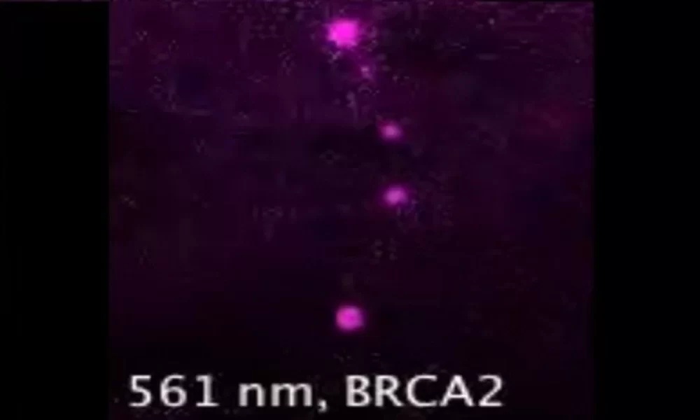 BRCA2 And Cancer: Understanding The Connection