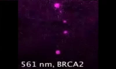 BRCA2 And Cancer: Understanding The Connection