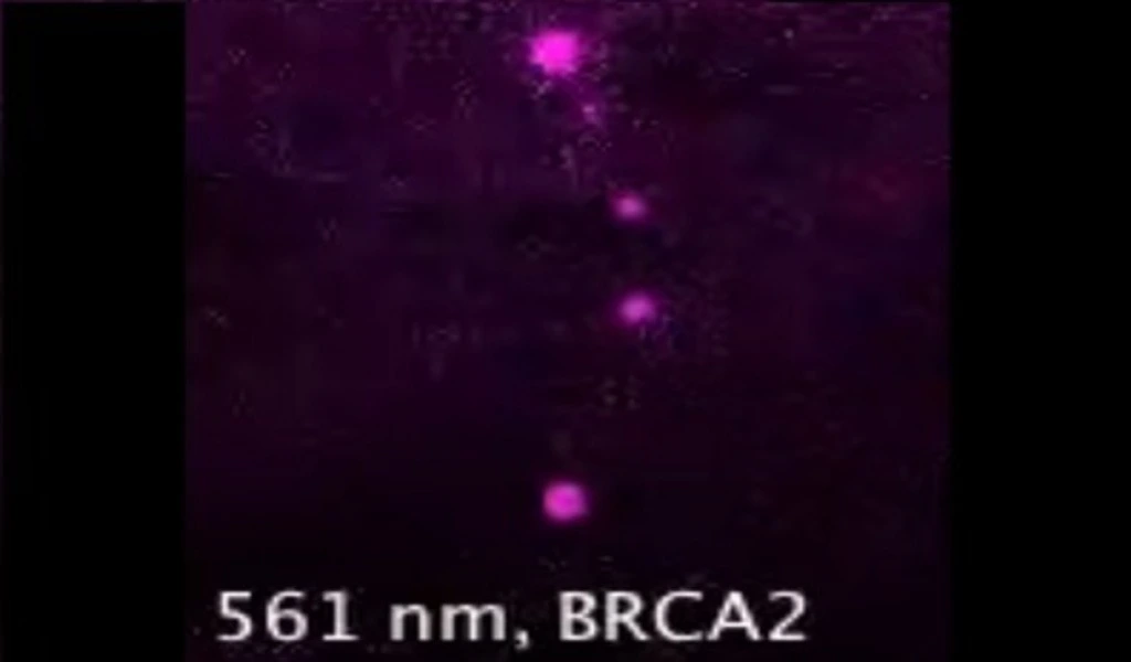 BRCA2 And Cancer: Understanding The Connection