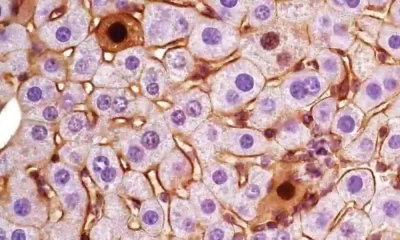 Cancer Genes Have Multiple Personalities That Can Be Identified