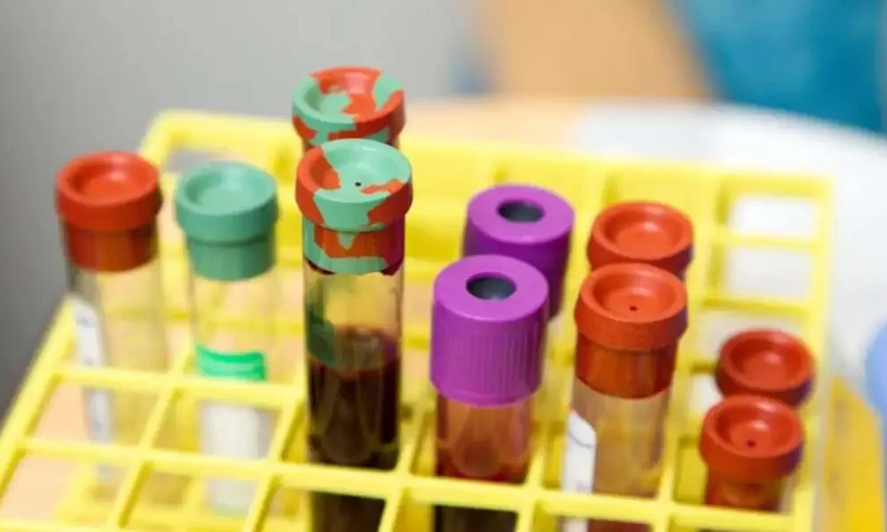 Blood Cancer And Obesity Are Linked, Researchers Find