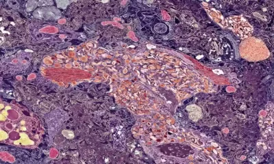 A Rare Alzheimer's Mutation Delayed The Onset Of The Disease In One Man