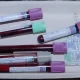 Study Suggests Blood Tests Could Speed Up Cancer Diagnosis For 50 Types