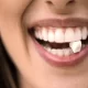 How Do I Know If My Clear Aligners Fit Properly?