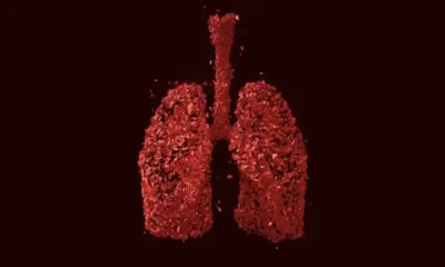 Lung Bacterial Colonization Is Also Influenced By The Host Genome