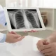 What is Diagnosis for Pneumonia, Thesis Writing & term Paper Writing Help