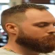 10 Best Hairstyles for Balding Men