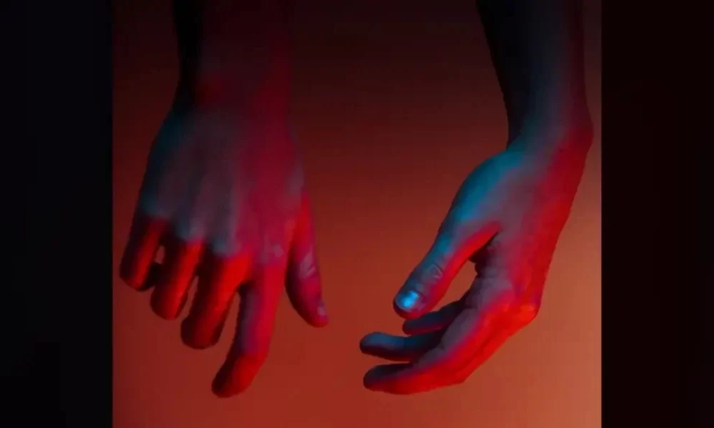 Leprosy Cases Are On The Rise In Central Florida: CDC