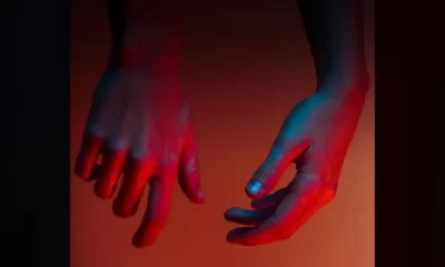 Leprosy Cases Are On The Rise In Central Florida: CDC