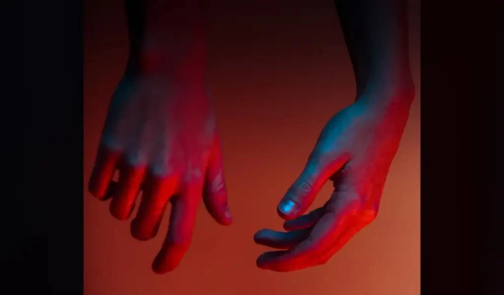 Leprosy Cases Are On The Rise In Central Florida: CDC