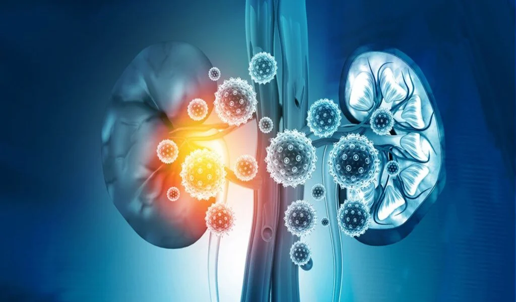 5 Common Causes Of Kidney Damage And How To Shield Your Kidneys
