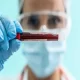 Alzheimer Treatment Approved By Japan For Leqembi