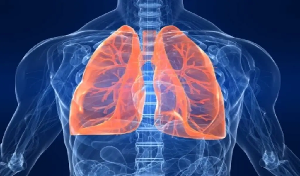 Women's Lung Cancer Risk May Be Boosted By Reproductive Factors