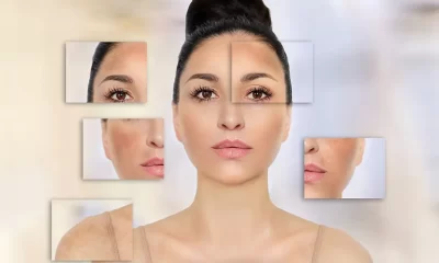 Skin Pigmentation
