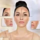 Skin Pigmentation