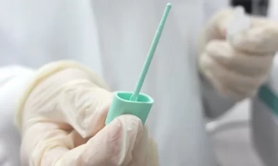 Testing for Cancer at Home: A Game Changer in Bowel Cancer Diagnosis