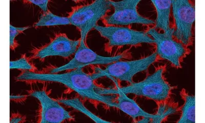 Cervical Cancer Risk Could Be Cut With Already-Approved Drugs
