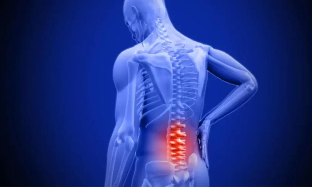 Innovative Treatments for Lumbar Spinal Stenosis: Discovering the Best Options