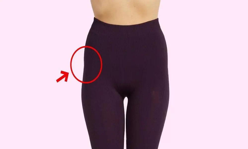 Understanding Hip Dips: A Normal Variation in Body Shape