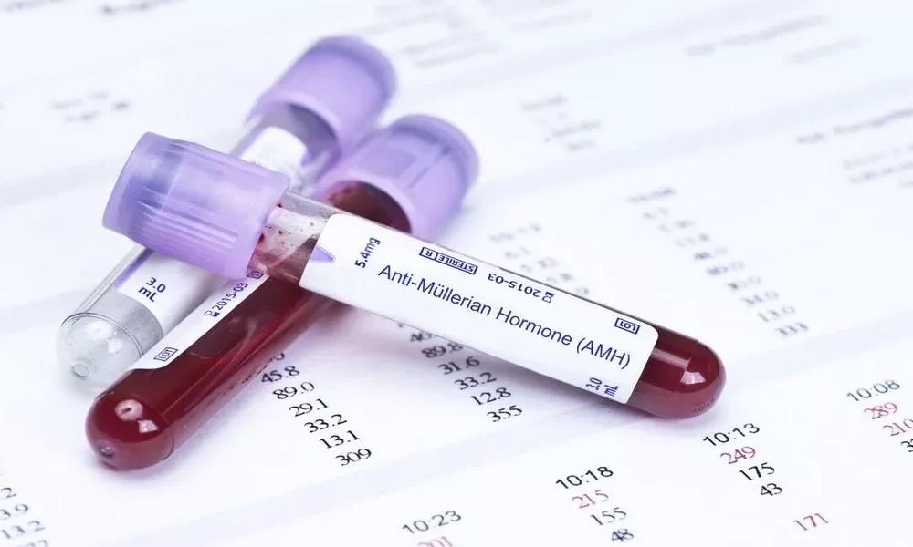 Which fertility Tests Are Done Before IVF?