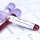 Which fertility Tests Are Done Before IVF?