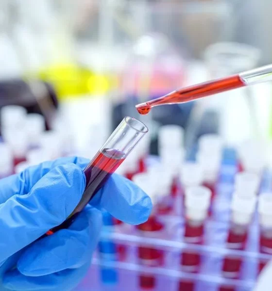 In 2023, HIV Cases And Deaths In Bangladesh Hit Record Highs.