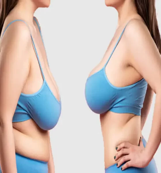 The Complete Guide To Breast Plastic Surgery Procedures