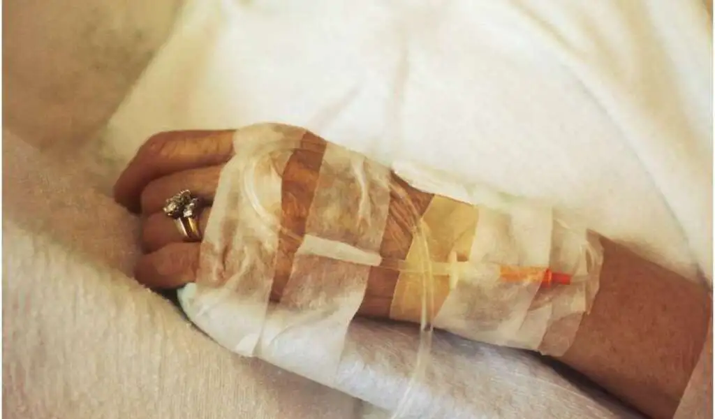 Radiology Predicts Bladder Cancer Patients' Lymph Node Metastases