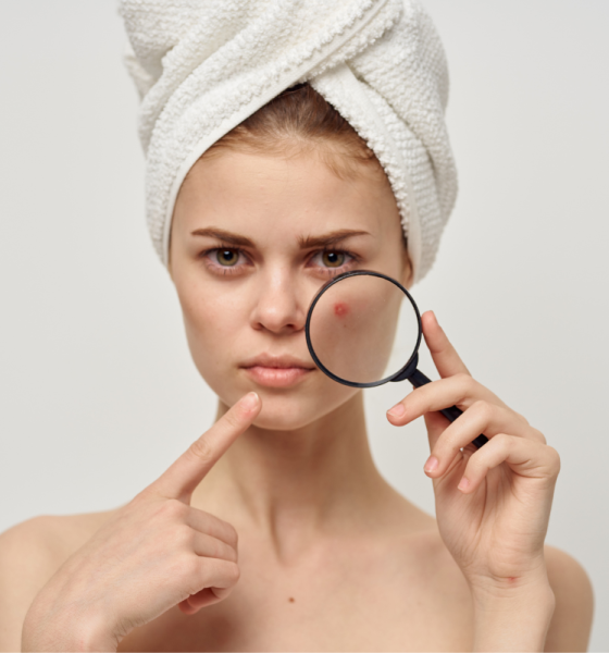 DSK Clinic's Exclusive Custom Scar Planning, Tailored Care Solutions for those battling acne!