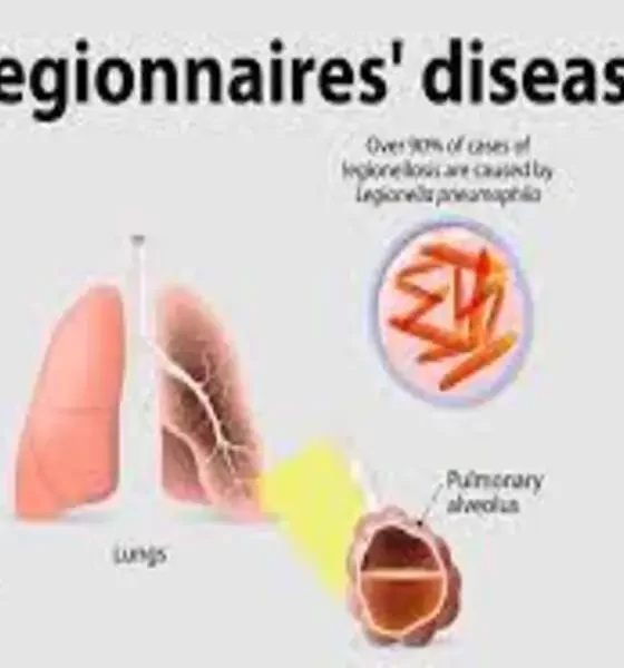 Grand Rapids Legionnaires' Disease Outbreak Source Identified