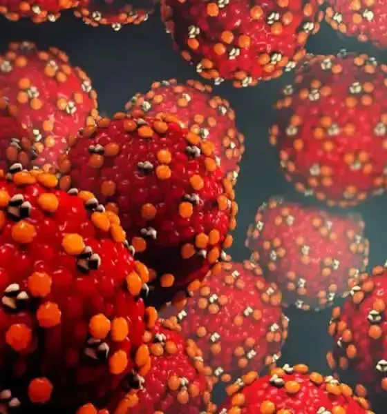 Measles Exposure At Cincinnati Airport, Ohio Health Officials Warn