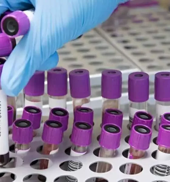 Some Advanced Breast Cancers Resist Hormone Therapy, According To Researchers