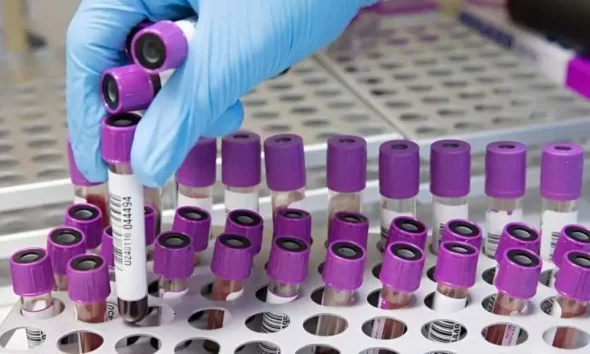 Some Advanced Breast Cancers Resist Hormone Therapy, According To Researchers