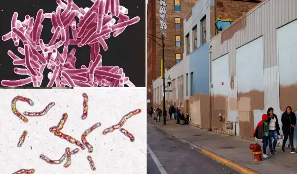 Following Measles Cases, TB Breaks Out In Chicago Migrant Shelters