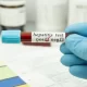 Hepatitis E