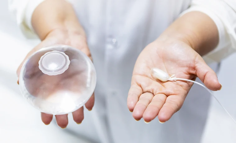 Gastric balloon